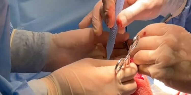 Бүгін урология бөлімшесінде жоспарлы оталар сәтті өтті.